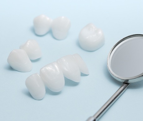 Multiple types of metal-free dental restorations