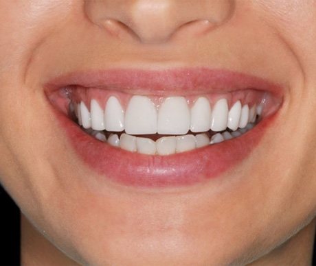 Close-up of woman’s smile with healthy pink gums