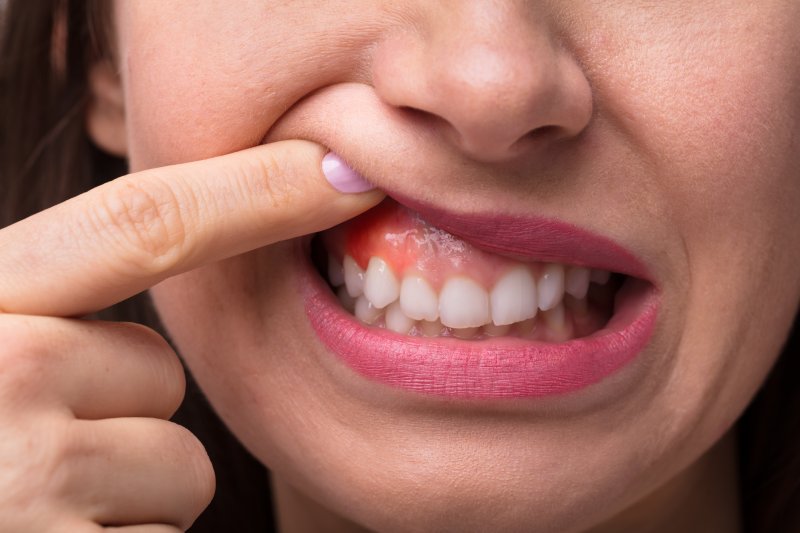 A woman with swollen gums